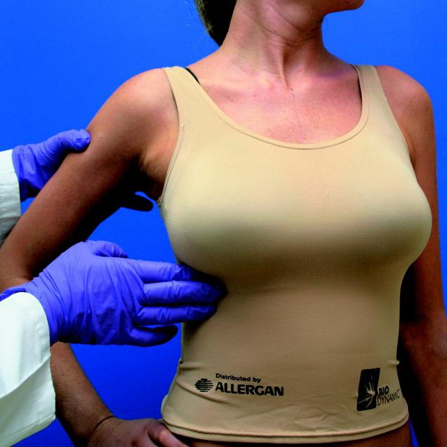 Ventajas y desventajas del aumento mamario con implantes: pros y contras del aumento de pecho