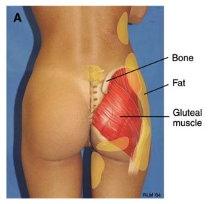 24.1-forma-gluteo