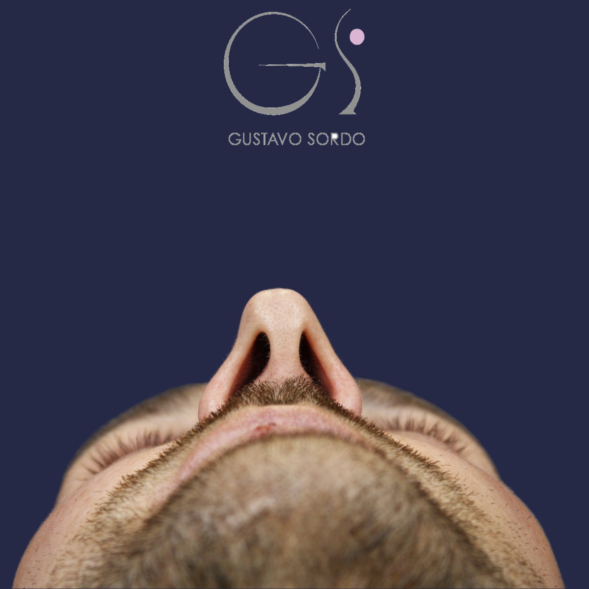 Rinoplastia estructural con corrección de desviación y colapso de válvula externa — antes. Caso operado por el Dr. Gustavo Sordo en Madrid