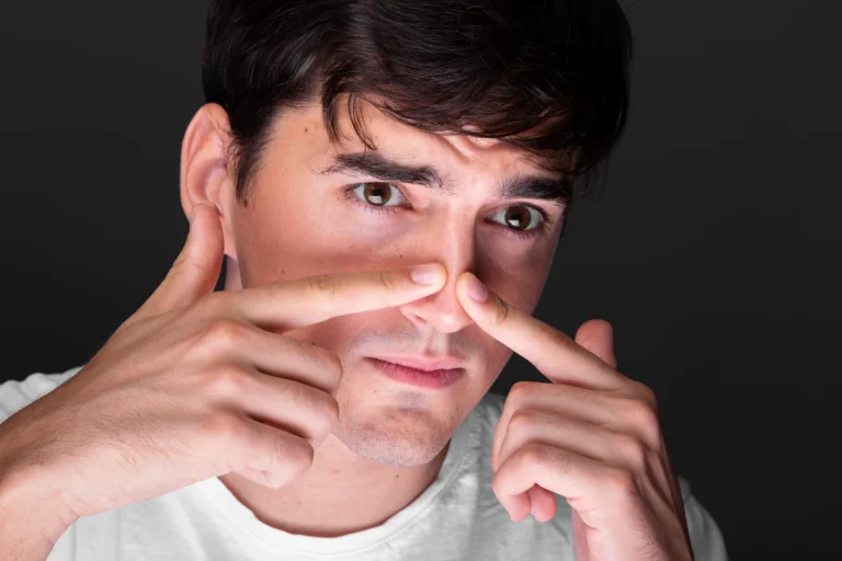 Rinofima: Qué es, Causas y Tratamiento — artículo del blog del Dr. Gustavo Sordo