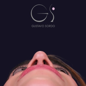 Rinoplastia mujer punta caída, resultado tras la cirugía — caso operado por el Dr. Gustavo Sordo en Madrid (4)