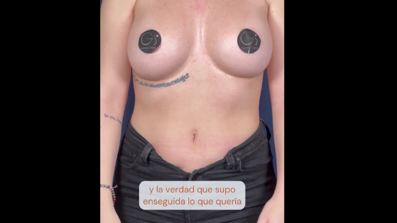 Video van Dr. Gustavo Sordo