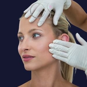 Ilustración del tercio superior facial en frontoplastia