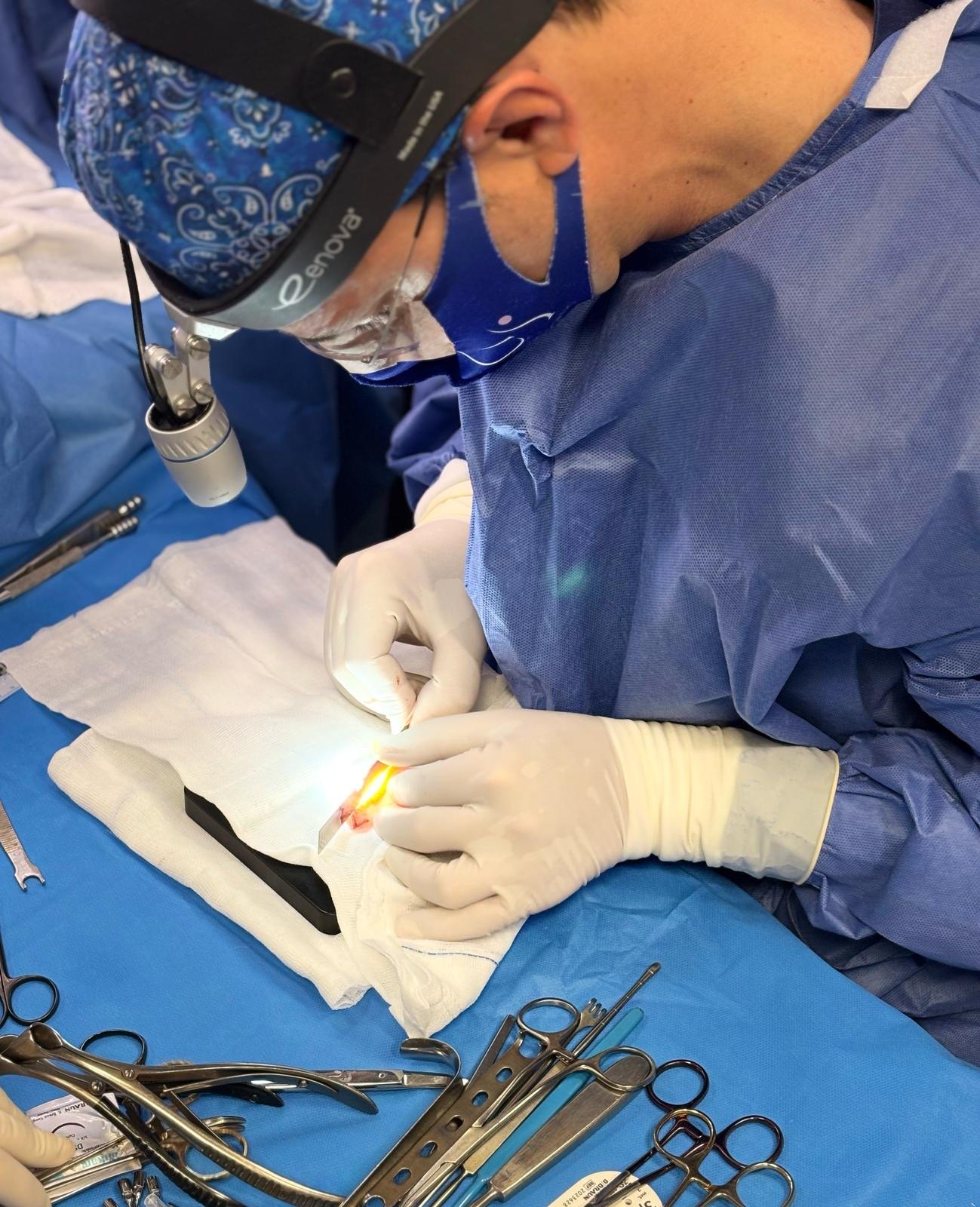El Dr. Gustavo Sordo tallando un injerto de cartílago costal durante una rinoplastia