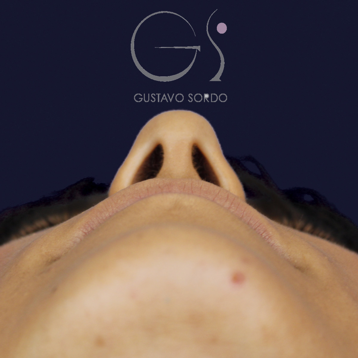 Rinoplastia estructural en piel fina, vista basal, antes de la cirugía — caso del Dr. Gustavo Sordo en Madrid