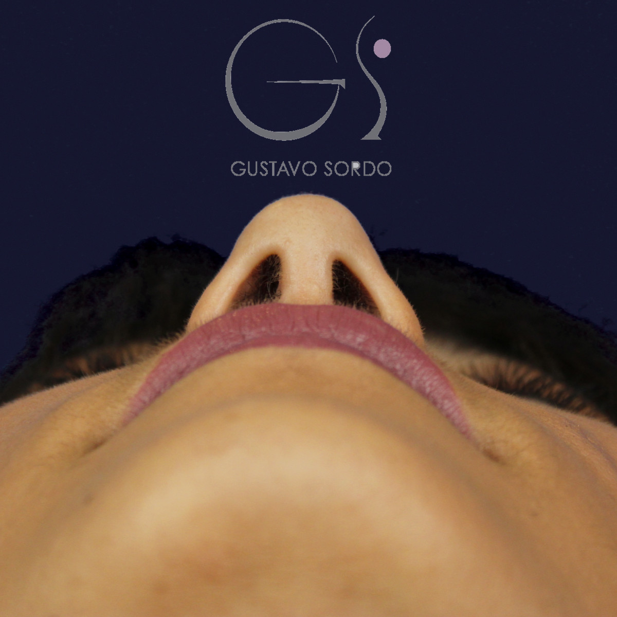 Rinoplastia estructural en piel fina, vista basal, al año de la operación — caso del Dr. Gustavo Sordo en Madrid