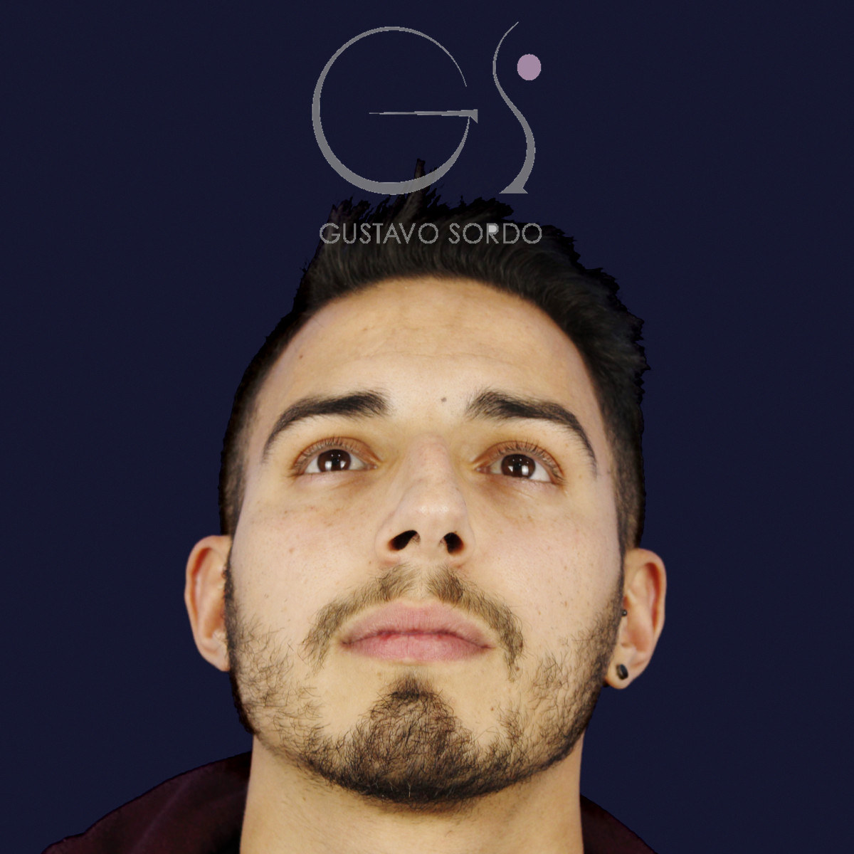 Antes de rinoplastia en hombre con caballete y nariz desviada, vista frontal con el mentón arriba