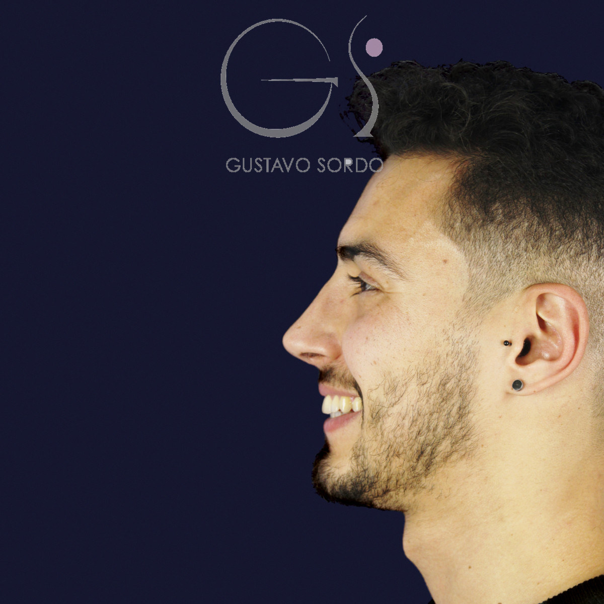 Después de rinoplastia en hombre con caballete y nariz desviada, a los once meses, vista de perfil izquierdo sonriendo