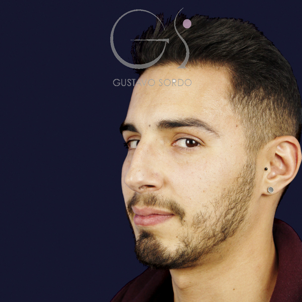 Antes de rinoplastia en hombre con caballete y nariz desviada, vista de semiperfil izquierdo