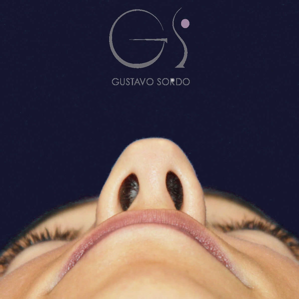 Antes de rinoplastia en nariz ancha con dorso en V, vista basal