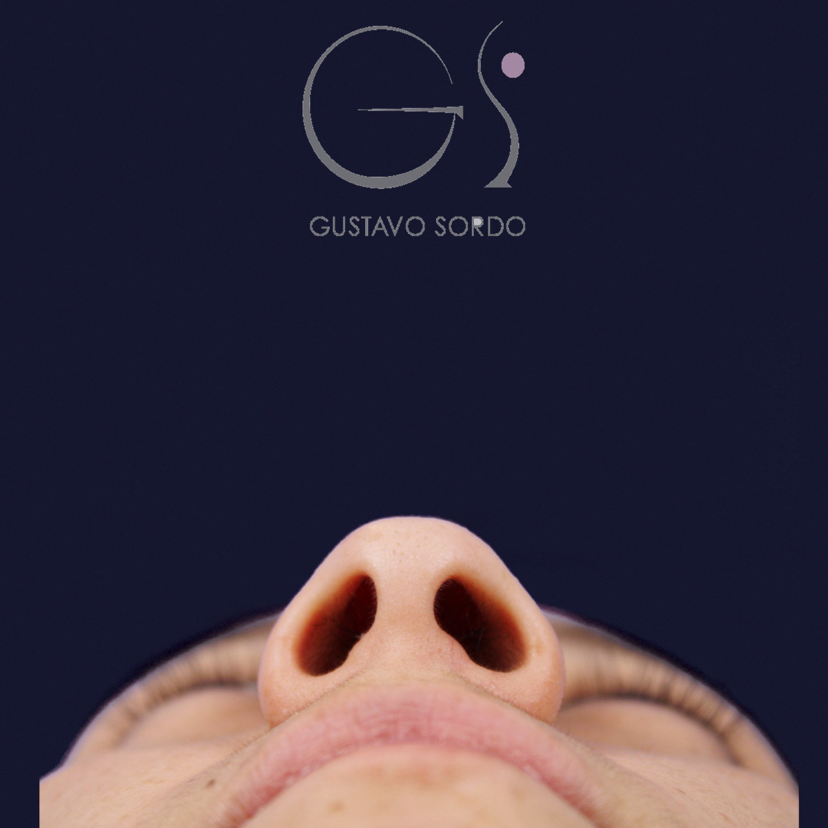 Before rhinoplasty on a wide nose with a hump, basal view, from below