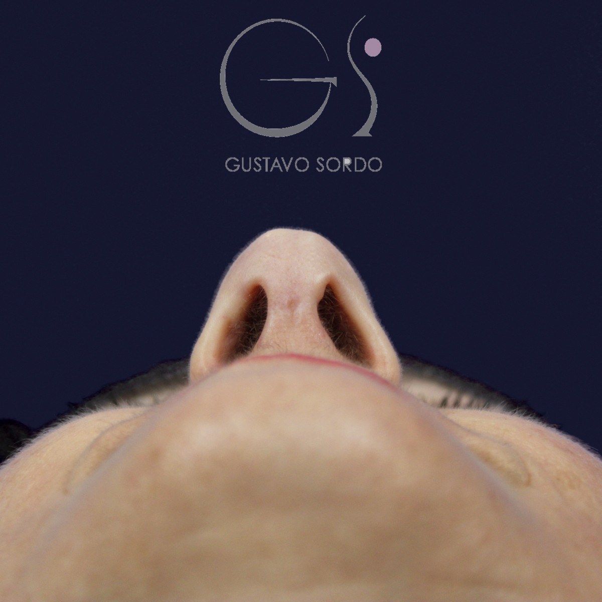 Después de rinoplastia con radix bajo, caballete y punta bífida, a los 14 meses, vista basal, desde abajo