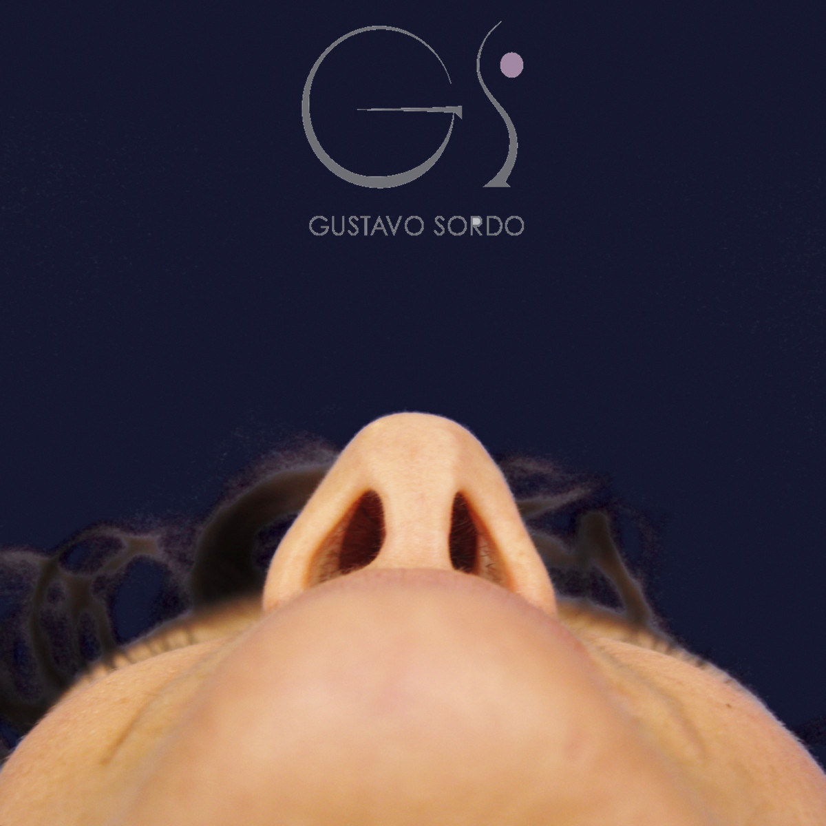 After extracorporeal rhinoseptoplasty for a severely deviated septum, at age six, basal view