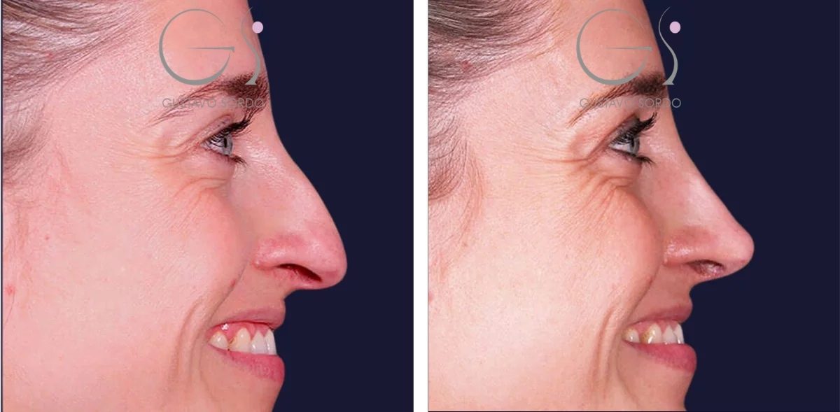 00_portada-carrusel-rino-copia_mavz5_211-r1ewa7nudy2s7mykzobd68493itofd2fmdb7y3t6v6-r5kakj63wwykrjjqzrc30terxgrrv7dio2qfotzxtu-r8c8eagqdehe2lyuw92g2gacj4ievrrzl9aj22so3m