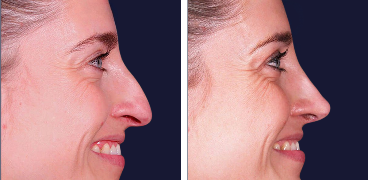 00_PORTADA-CARRUSEL-RINO-copia_MAvz_211-r1ewa7nudy2s7mykzobd68493itofd2fmdb7y3t6v6-r5kakj63wwykrjjqzrc30terxgrrv7dio2qfotzxtu