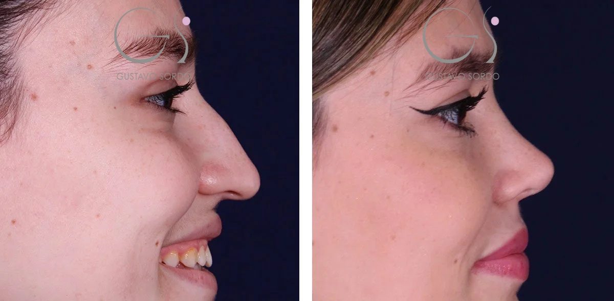 1075B2743-BE95-44FF-8082-65905E7D1F3D-r1eumztvtp0gs0z6s2ti362ttmp7htz7h9pzijm2v6