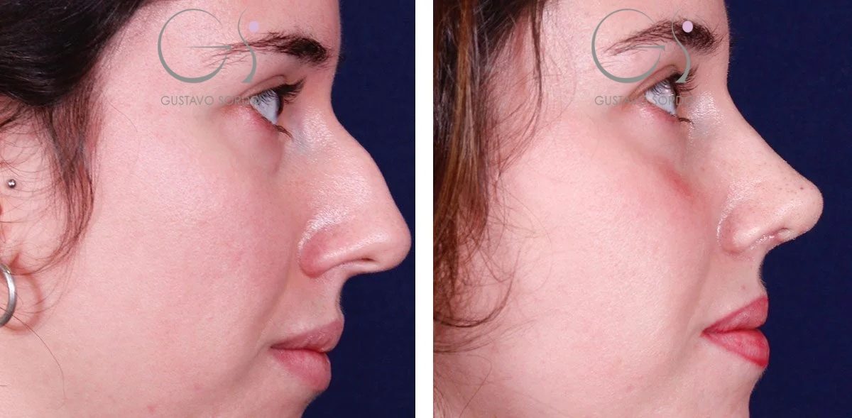 1452FA7D-3637-4A52-848C-BF9123D9952E1-r1ev915o1v6gywyu3lqmjlvv6u2zydgnucbsk2xszm