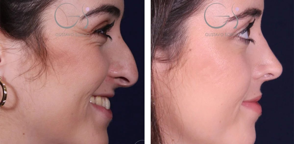 2-11-r1evxc9esmgf7vnp5m0aiz208k9q0kyrinoucowa2q