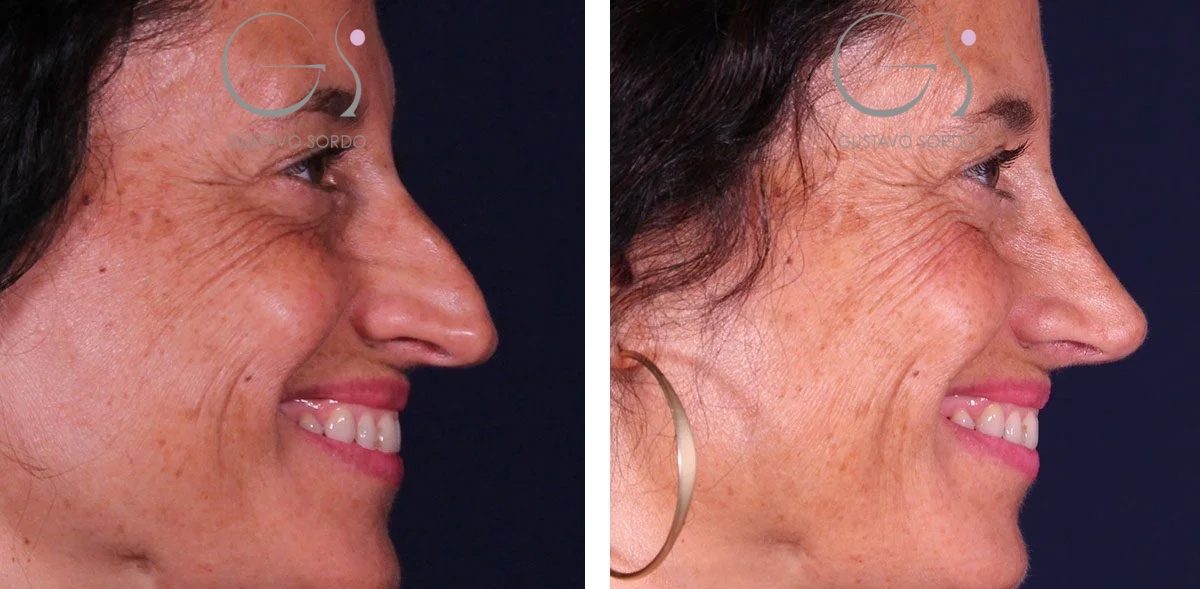 2C3EA34F-B89A-46B1-9C1B-AED82A0EF3891-r1evoxldnyy3dfvc8z6f83fkyhpj61l711mhtld1qa