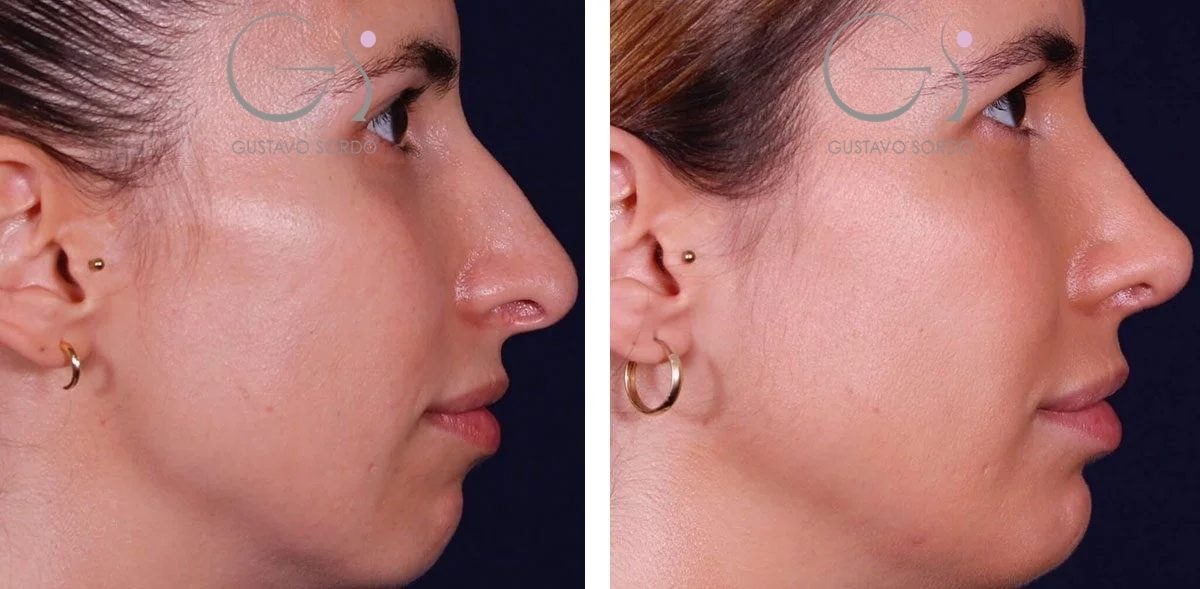 3B5CCAC2-0B86-4044-B04D-C6520C11CC811-r1ewq5z8dpwz9dscu2kezp6w1y6y2fefhbww665n9e