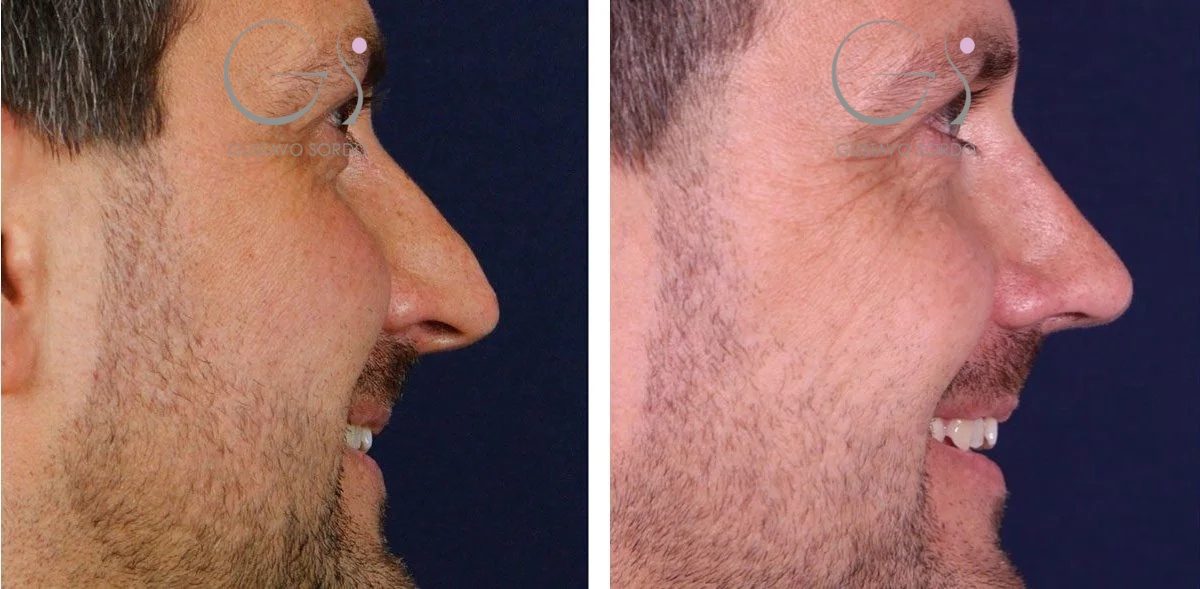 4DD65597-AA84-4BF8-B6C9-9C502E43C1271-r1ev6ksu7ftinkj6fjjp186jcm6hutpw6705g2kt8i-1-r8zrf5nzpkx2shdlyyltpom4011wcacemxogvqpvr6