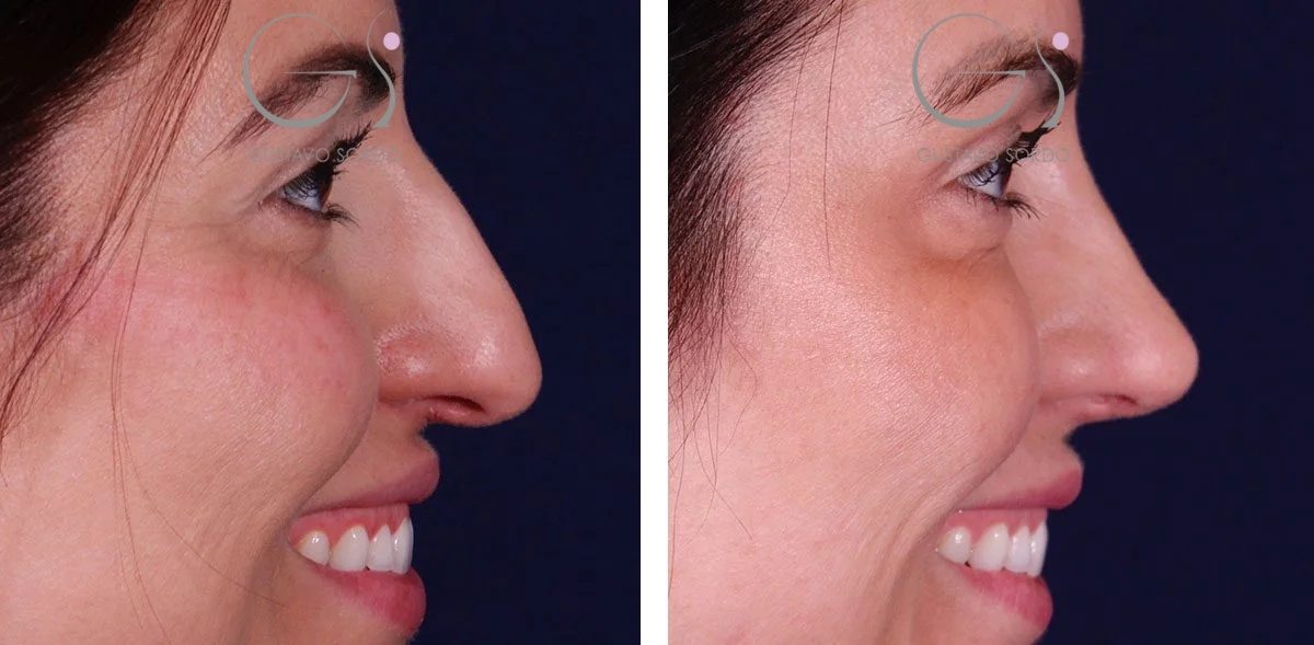 798B2C22-3BF2-495D-9EE5-7BB6545C7FD91-r1ev1ssdgra1mxh1bz6yuxl6n3qbq7r0ijmamfnuv6