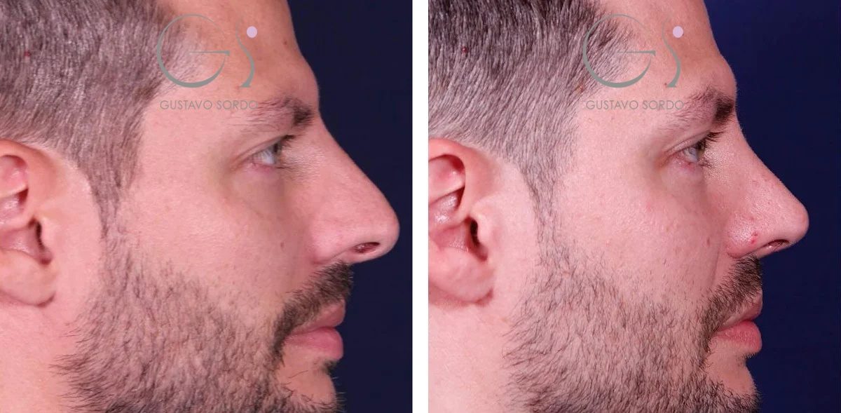 8F4F5F23-8358-446A-BFDC-FAEDC962D75D1-r1ewhhwtcq1s6udngbo9zvxuu0x32wzjmfboub0cn6-r8c8eqfzll39jzbnaxz3qu96mobnimjfbgds7s4z5u