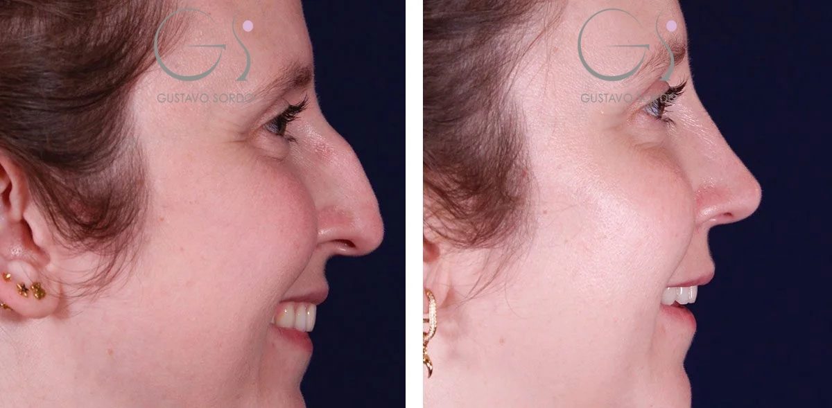 8FC871E6-8AC9-4BF7-B86B-DA6FE1F23027-22-r1evks51hb9i3fwfhokqpn5ai866663vghwailin7m