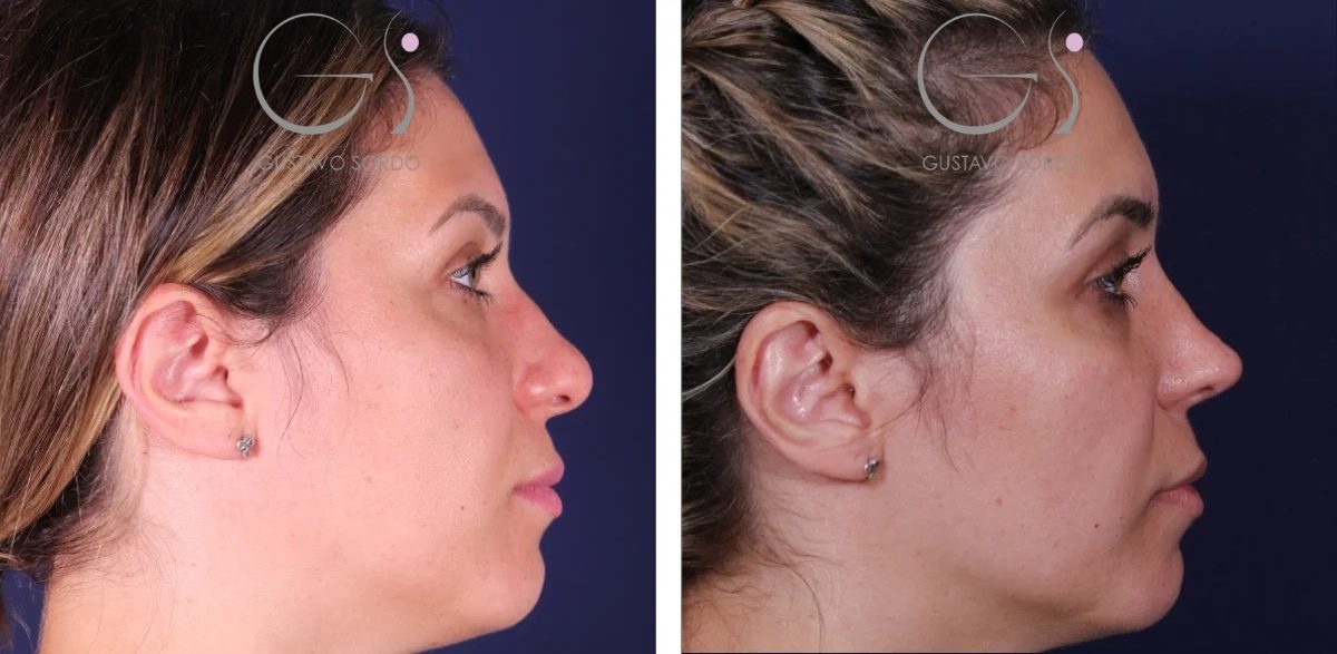 design-sem título-12