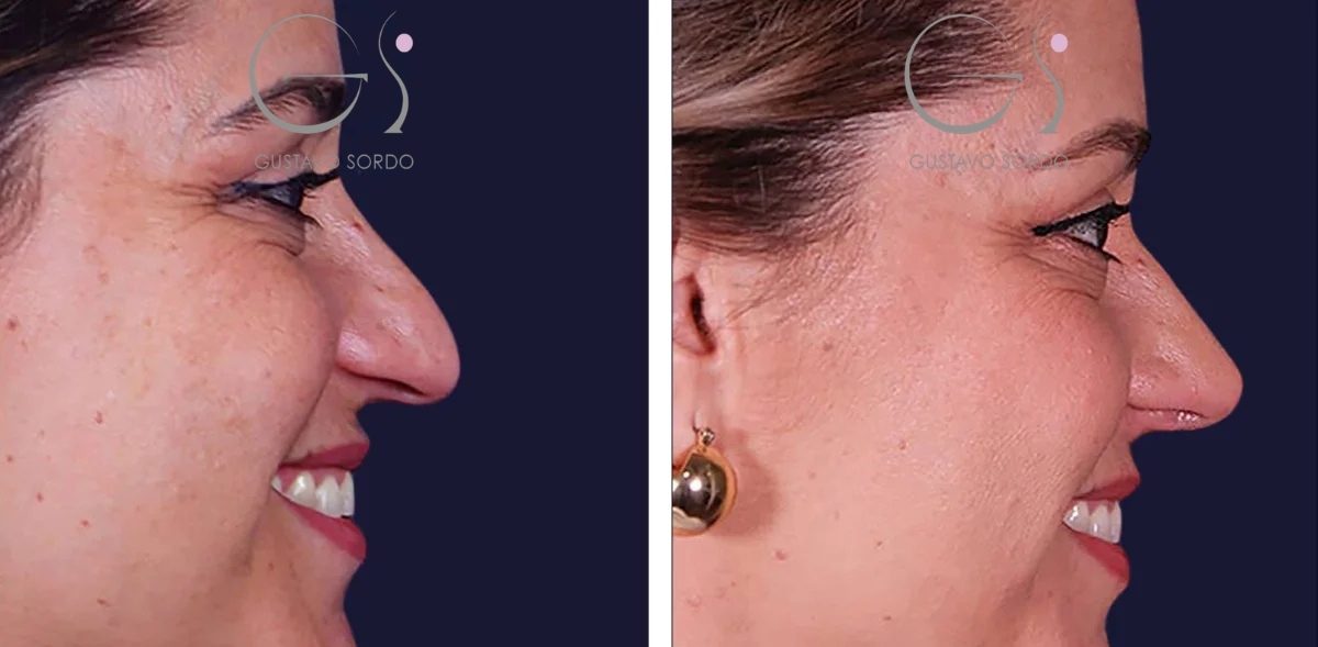 PORTADA_Rino_14_06_24-11-r1ew3cgagiode6xo37ghggi0v6o56yt10dqiqbzqbm-r5kak52j2ef9xe48a38oheyv0op9nqtjm4y5hokuf6-r8c8fmei1yb0iq184bsf3m6utry4sc2arukaj6tlaa