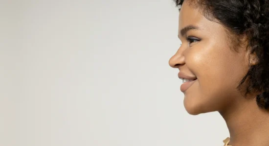 Rinoplastia — étnica en Madrid