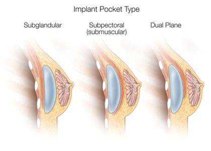 bolsillo-dual-plane-i-