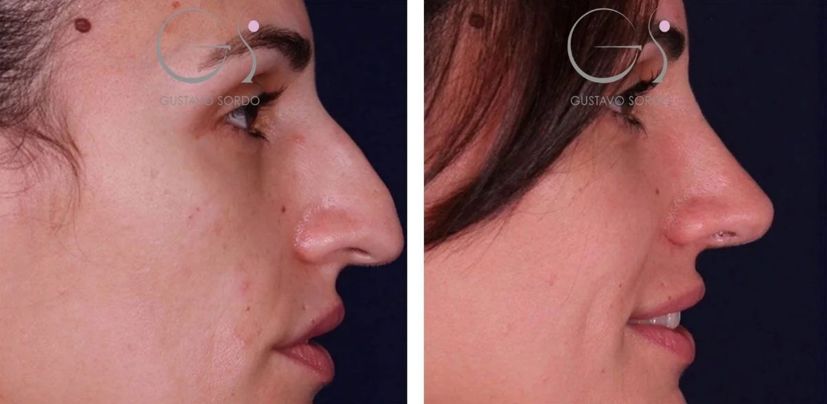 corregidorectangul3-r1ovso4z69bqaqyzn3ot8768ulj1irad248r0s63fy