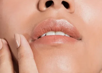 lip-lift-guia