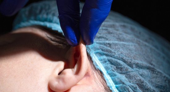 Otoplastia en Madrid