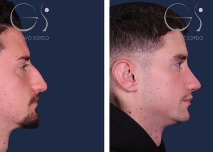 rino-hombre-f-r-portada