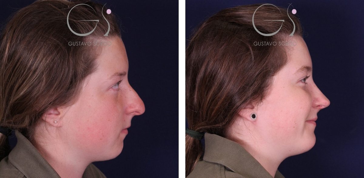 rino-preservacion-a-c23