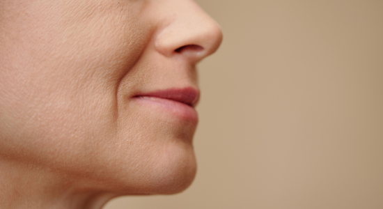 Lifting facial en Madrid